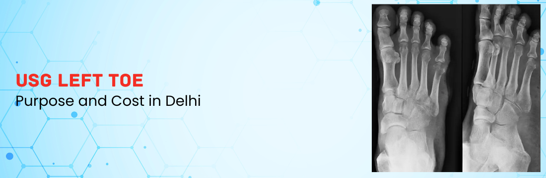 USG Left Toe: Purpose and Cost in Delhi